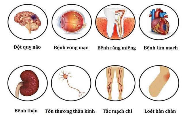 Lời khuyên tốt giúp bệnh nhân tiểu đường phòng ngừa và giảm nguy cơ biến chứng - Ảnh 1.