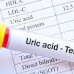 Ai có nguy cơ bị tăng acid uric máu?