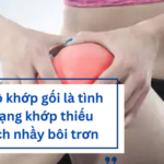 Khô khớp gối: Thông tin bạn cần biết để cải thiện bệnh